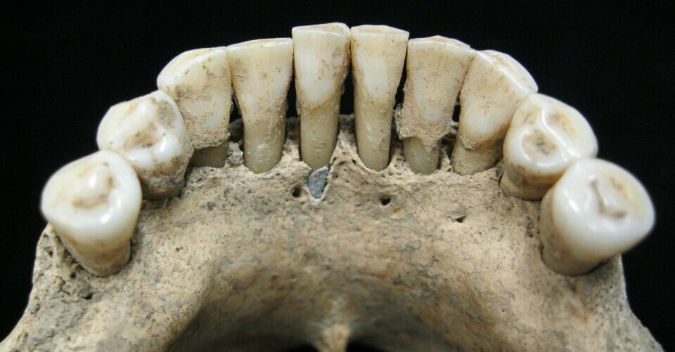 Τι γύρευε λίγο λάπις λάζουλι στα δόντια μιας μοναχής του Μεσαίωνα;