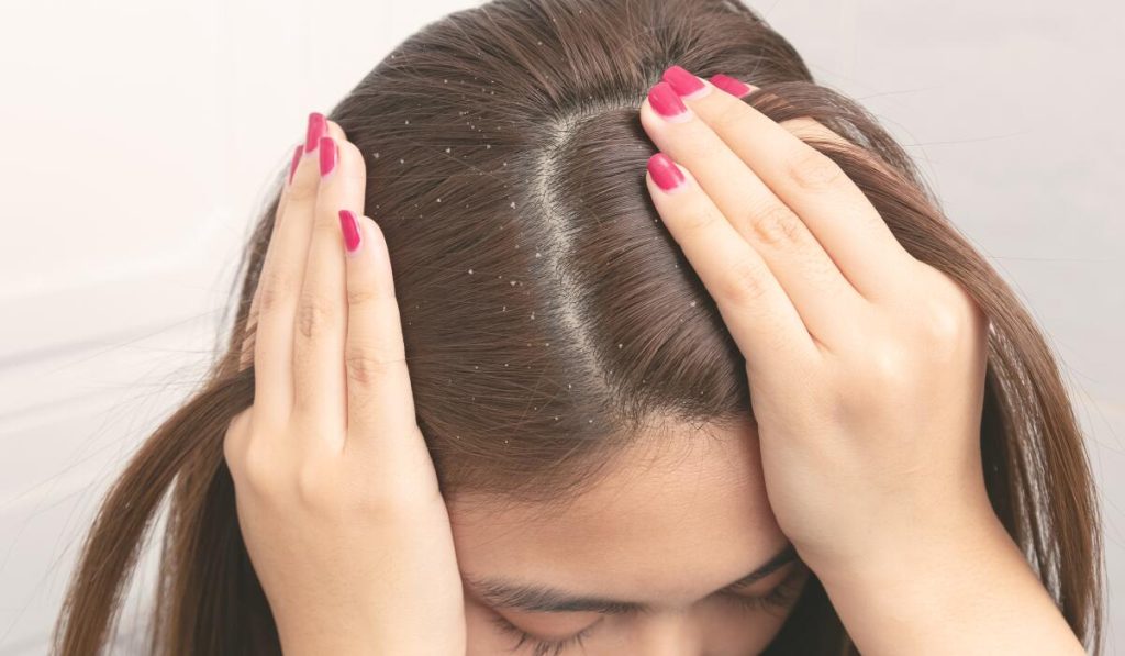 Όσα πρέπει να ξέρετε για την πιτυρίδα και την ξηροδερμία – Σε τι διαφέρουν και πώς αντιμετωπίζονται