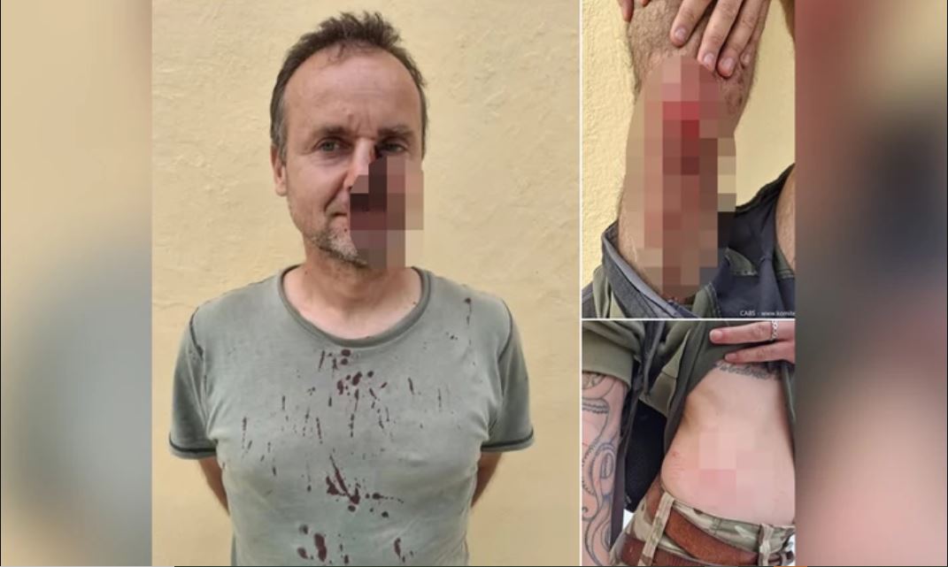 Άγριος ξυλοδαρμός ανθρώπων περιβαλλοντικής οργάνωσης από λαθροκυνηγούς στην Ζάκυνθο (φωτο)