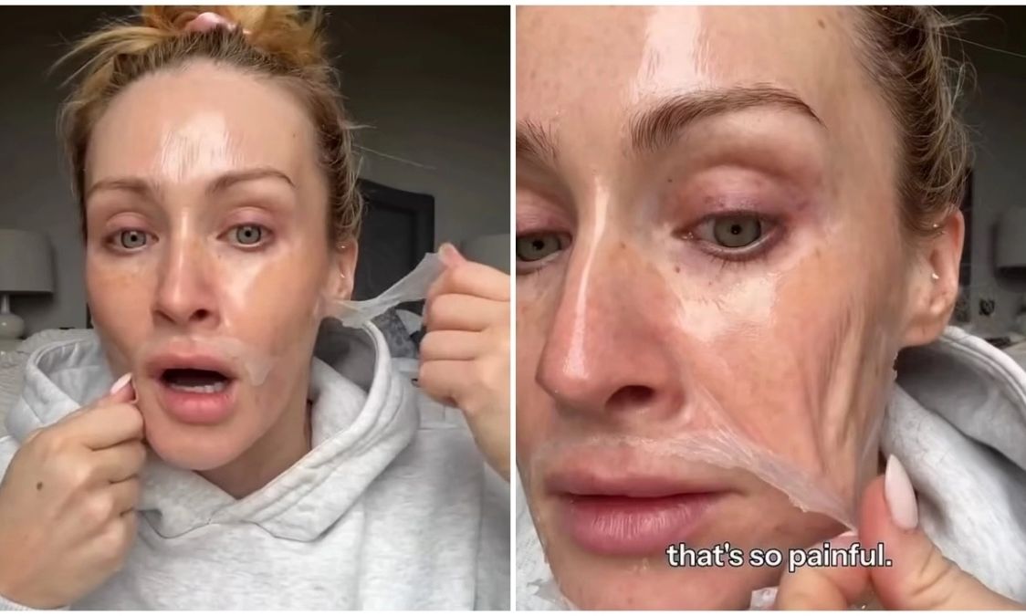 Σάλος με μάσκα skincare – Γυναίκα «πέθαινε» από τον πόνο κατά την αφαίρεσή της (βίντεο)