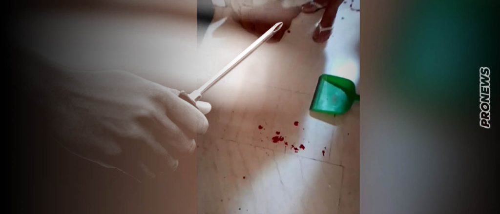 Με βαρύ ποινικό μητρώο η 40χρονη γνωστή ηθοποιός που τραυμάτισε σοβαρά με κατσαβίδι τον γείτονά της στον Βύρωνα