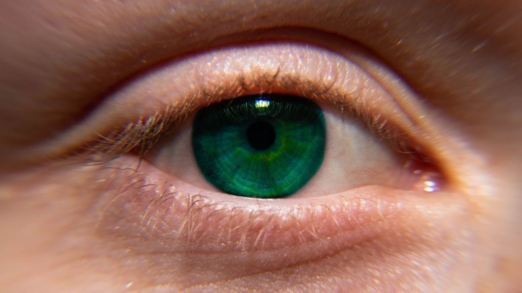 Κερατόκωνος: Tι είναι η πάθηση από την οποία πάσχει η Φαίη Σκορδά; – Τα συμπτώματα και από τι προκαλείται