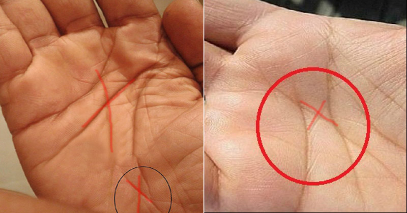 Μήπως έχετε το γράμμα «Χ» στην παλάμη σας; – Δείτε τι σημαίνει! (βίντεο)
