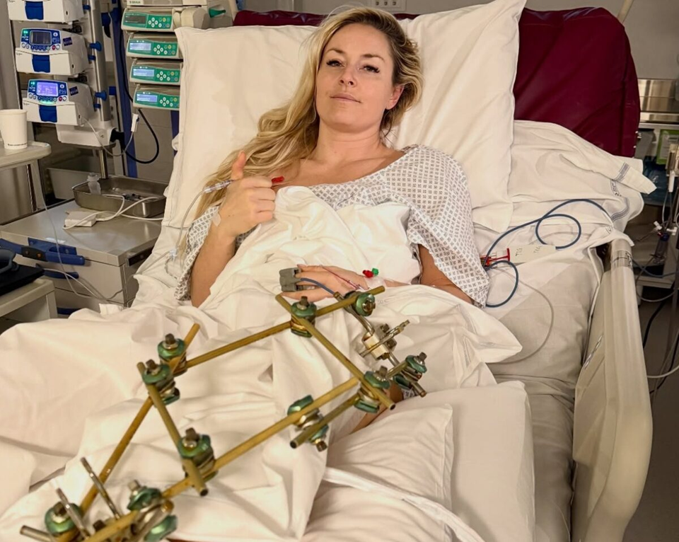 Η Λίντσεϊ Βον έκανε τρίτο χειρουργείο στο πόδι μετά τον τραυματισμό της στους Χειμερινούς Ολυμπιακούς (φώτο)