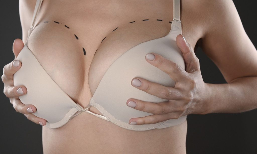 Η νέα τάση που προκαλεί αντιδράσεις: Παίρνουν λίπος από… νεκρούς για να κάνουν αυξητική στήθους και γλουτών!