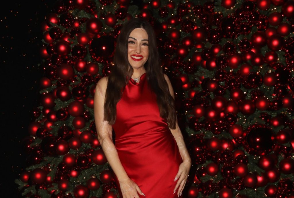 «Χτίζω τον εαυτό μου ξανά»: Φωτογραφίες δημοσίευσε από την πορεία αποκατάστασής της η Ι.Παλιοσπύρου